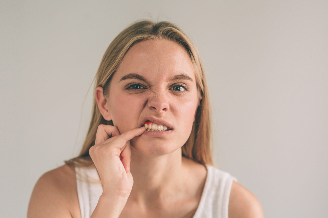 Bleeding Gums in Boulder CO