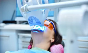 The Benefits of Professional Teeth Whitening in Boulder, CO